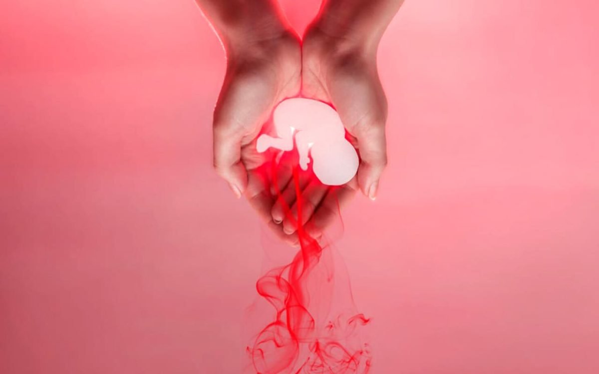 El aborto fue la principal causa de muerte en el mundo durante 2025 (Pinterest) WEB